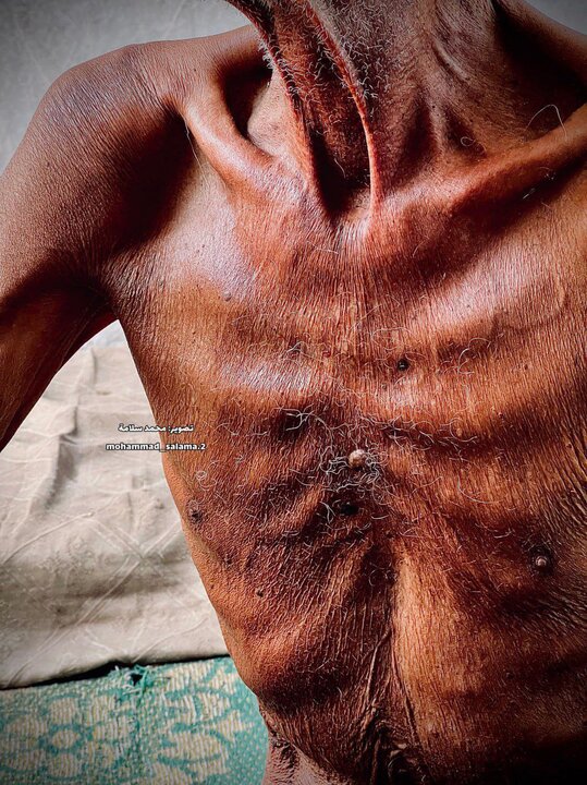 آنچه گرسنگی بر سر «سلیم عصفور» موذن مسجد صحابه غزه آورده است