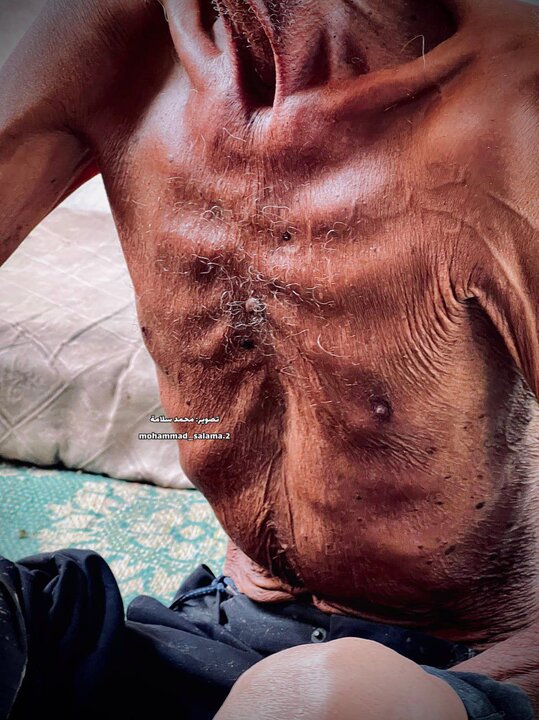 آنچه گرسنگی بر سر «سلیم عصفور» موذن مسجد صحابه غزه آورده است